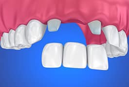 dentists mcdonough ga - dental care henry county georgia