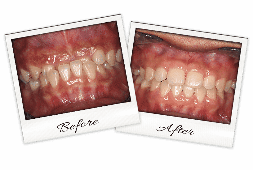Ortho-1