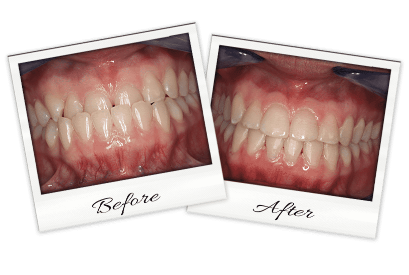 Ortho-2