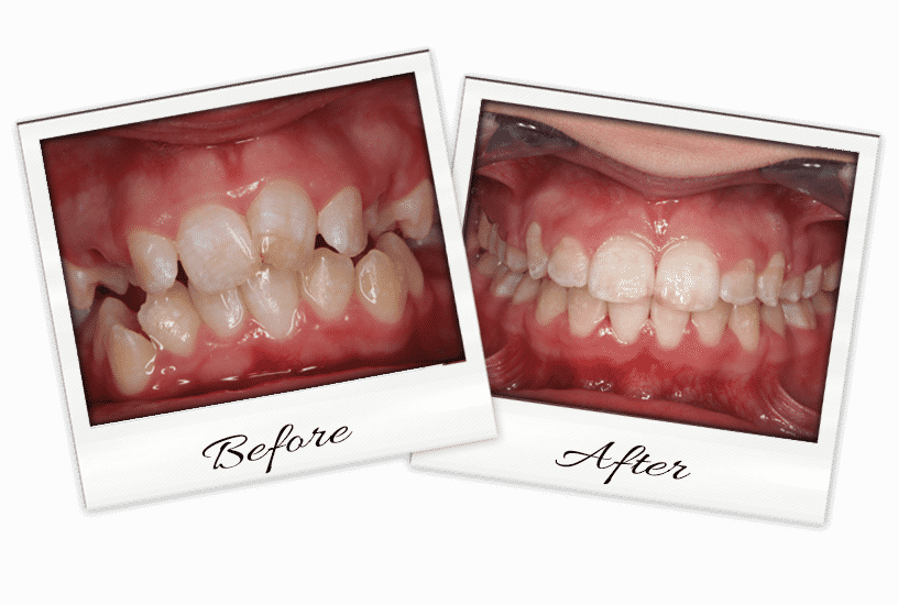 Ortho-3