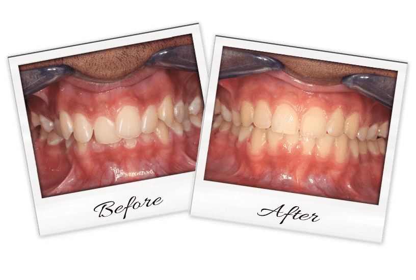 Ortho-4