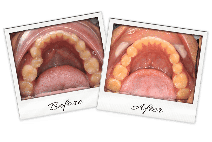 Ortho-6